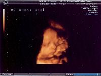 3D Ultrasound of my new neice or nephew!